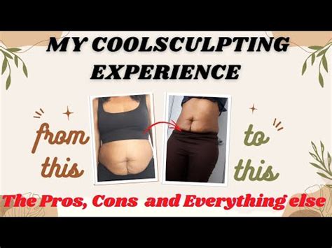 coolsclupting|pros and cons of coolsculpting.